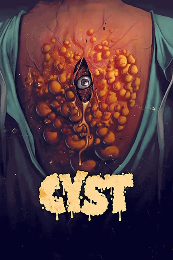 مشاهدة فيلم Cyst 2020 مترجم